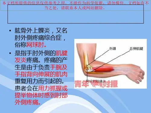 肱骨外上髁炎培训课件