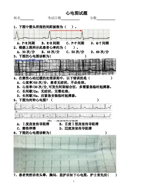 心电图试题