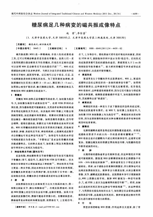 糖尿病足几种病变的磁共振成像特点