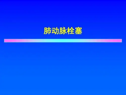 肺动脉栓塞