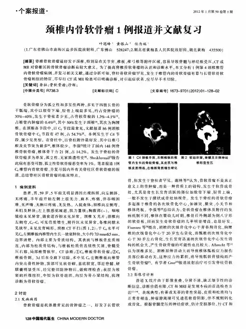 颈椎内骨软骨瘤1例报道并文献复习