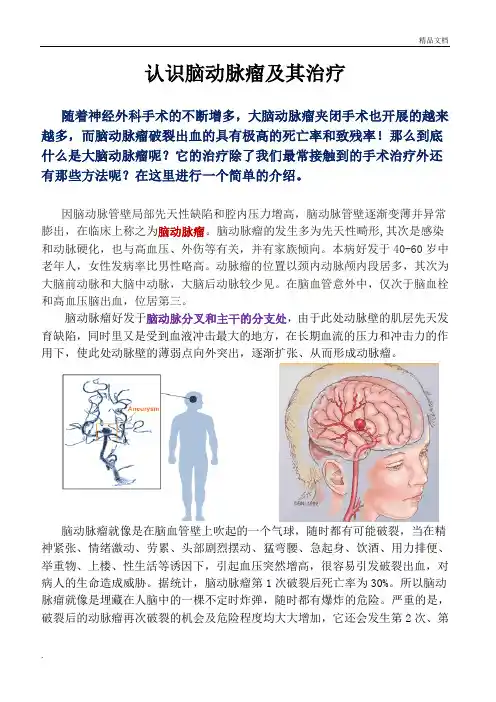 脑动脉瘤的概述与治疗