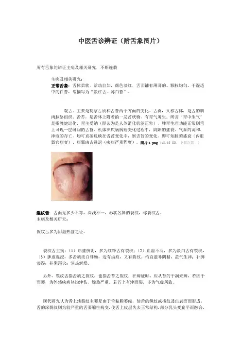 中医舌诊辨证