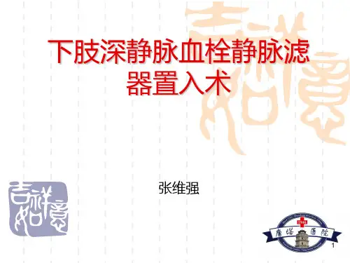 下腔静脉滤器置入术PPT课件