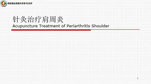 中医针灸学 针灸治疗肩周炎