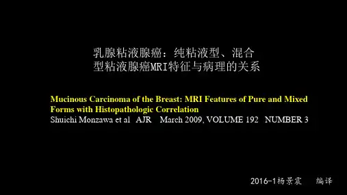 乳腺粘液腺癌MR与病理特点