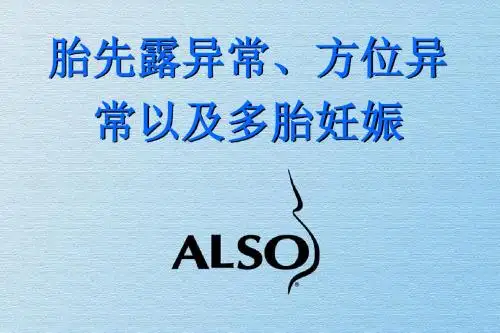 胎位异常的处理