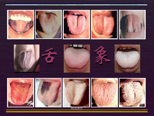 中医舌诊.ppt学习资料演示课件.ppt