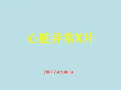 心脏异常胸片