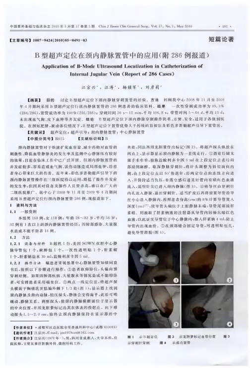 B型超声定位在颈内静脉置管中的应用(附286例报道)