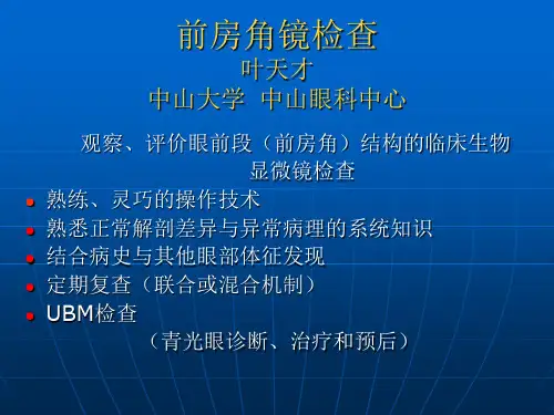 前房角镜检查