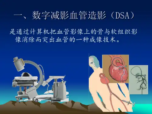 DSA设备及成像原理