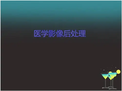 医学影像后处理