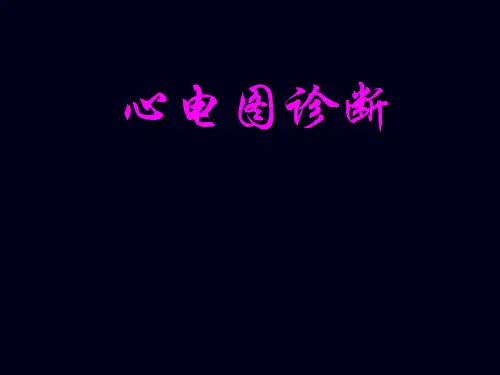 心电图诊断