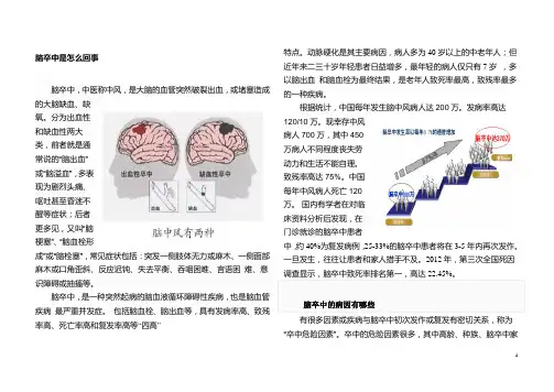 脑卒中健康教育宣传资料