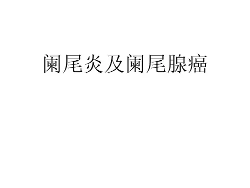 阑尾炎及阑尾肿瘤精品PPT课件