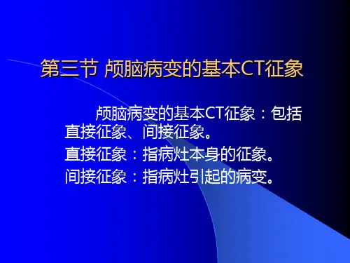 第三节 颅脑病变的基本CT征象