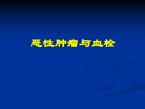 恶性肿瘤与血栓