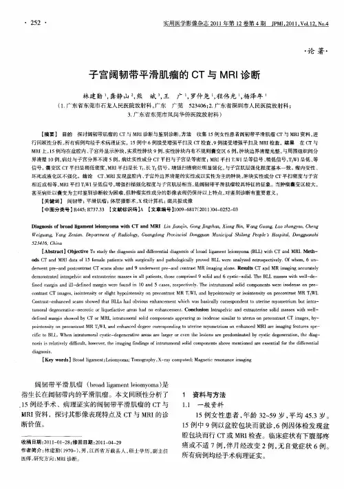 子宫阔韧带平滑肌瘤的CT与MRI诊断