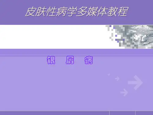 银屑病病因与发病机理 PPT课件