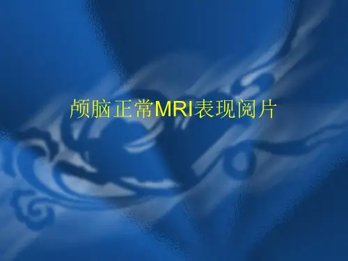 颅脑正常MRI表现阅片