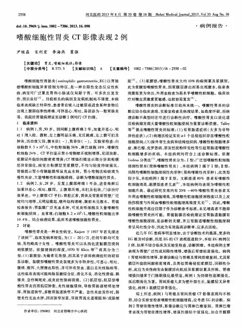 嗜酸细胞性胃炎CT影像表现2例