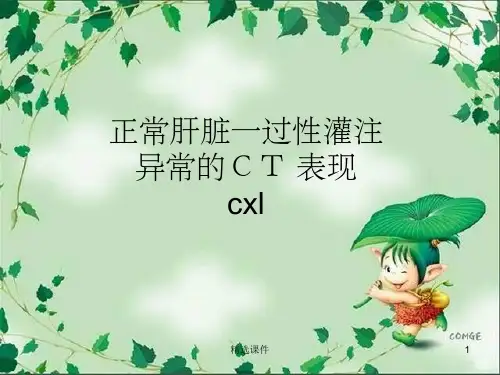 一过性肝脏CT灌注异常强化