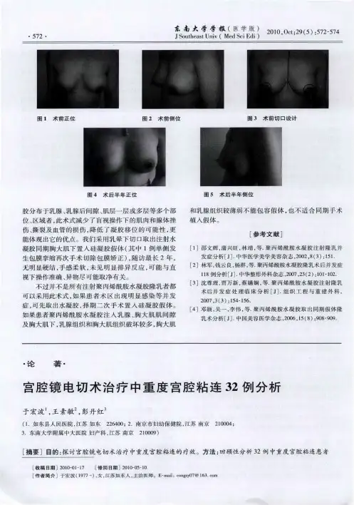 宫腔镜电切术治疗中重度宫腔粘连32例分析