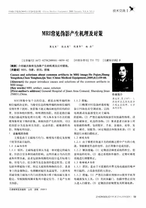 MRI常见伪影产生机理及对策