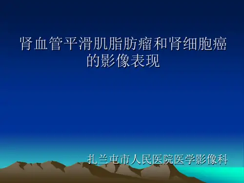 肾脏良恶性肿瘤影像表现详解