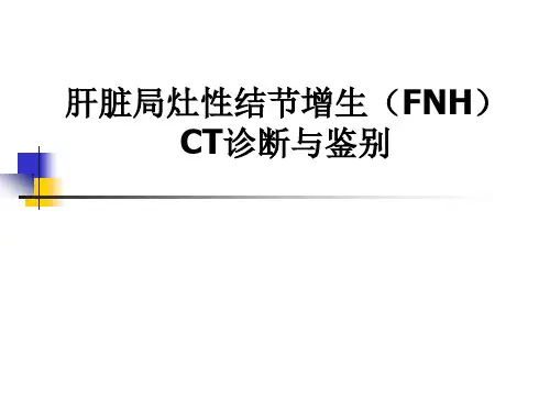 肝脏局灶性结节增生CT诊断与鉴别