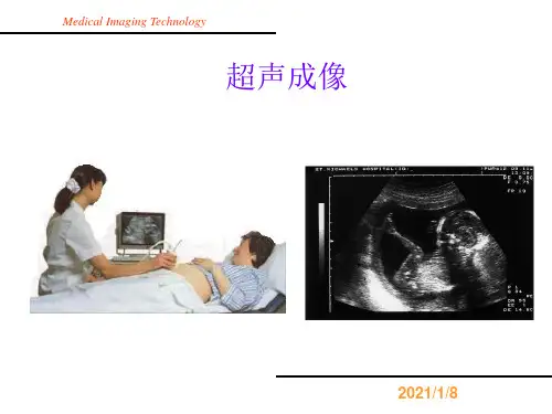 医学图像技术---超声成像课件