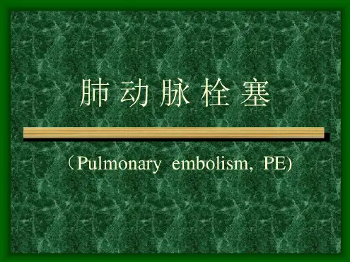 肺动脉栓塞(1)