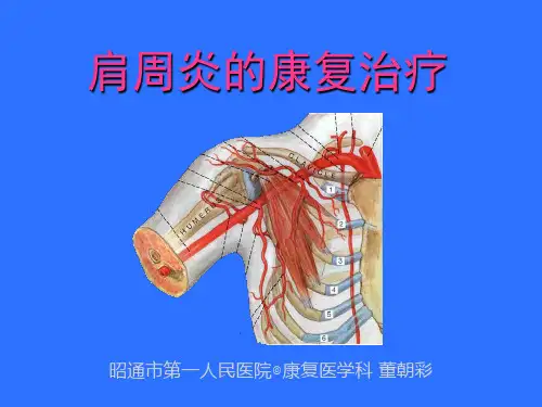 肩周炎康复dong教学案例