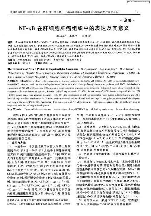 NF—κB在肝细胞肝癌组织中的表达及其意义