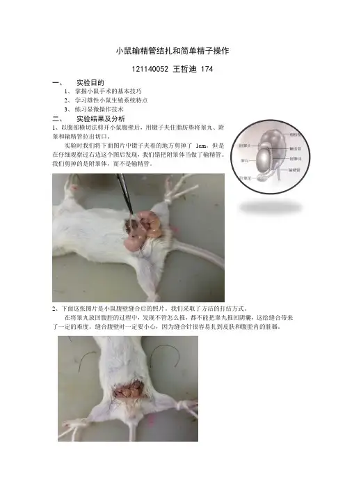 小鼠输精管结扎和简单精子操作