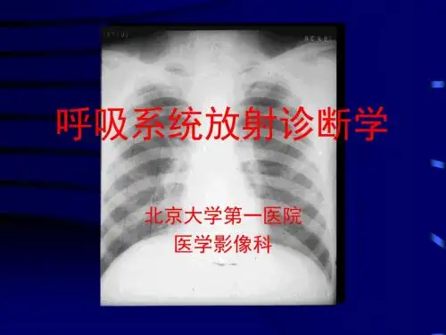 呼吸系统放射诊断学-1