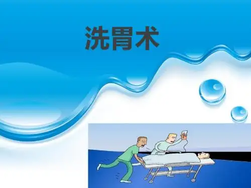 洗胃术