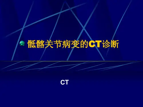 骶髂关节病变的CT诊断