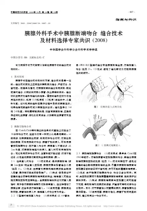 胰腺外科手术中胰腺断端吻合缝合技术及材料选择专家共识_2008_