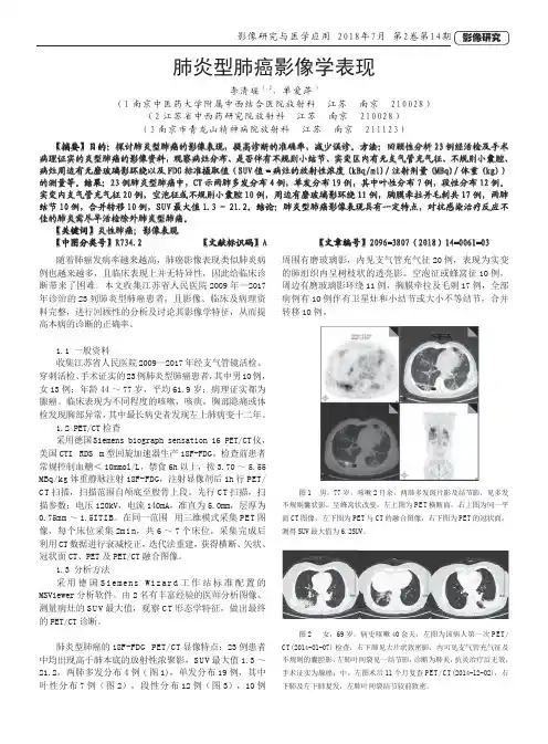 肺炎型肺癌影像学表现