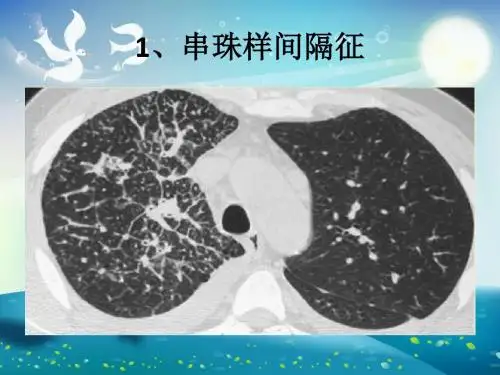 胸部医学影像征象总结课件