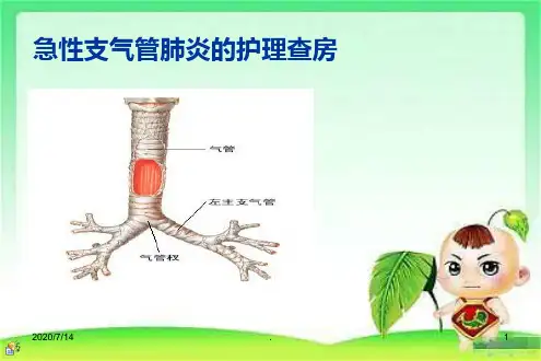 小儿急性支气管炎的护理查房-PPT课件