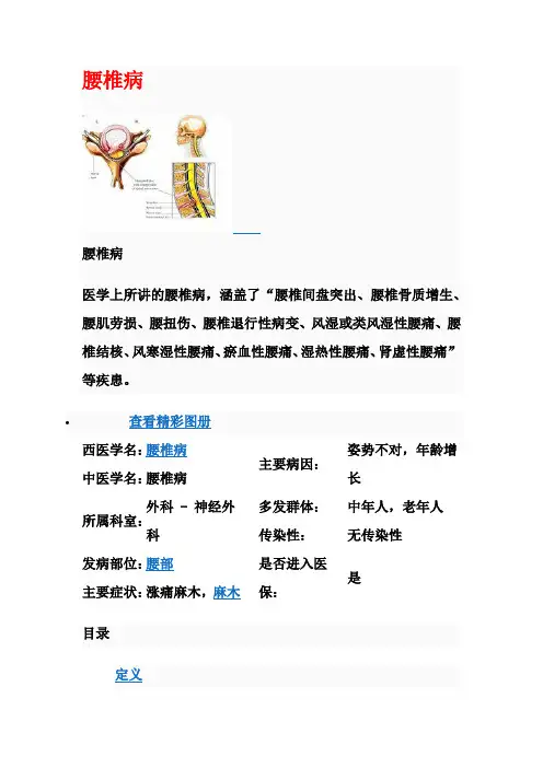 百度百科腰椎病