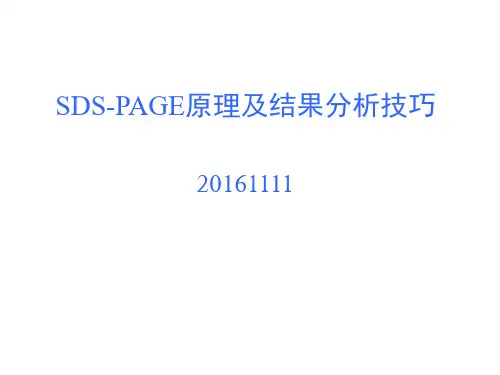 SDS-PAGE原理及结果技巧分解