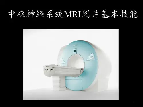 中枢神经系统疾病MRI基本阅片技能PPT精选文档