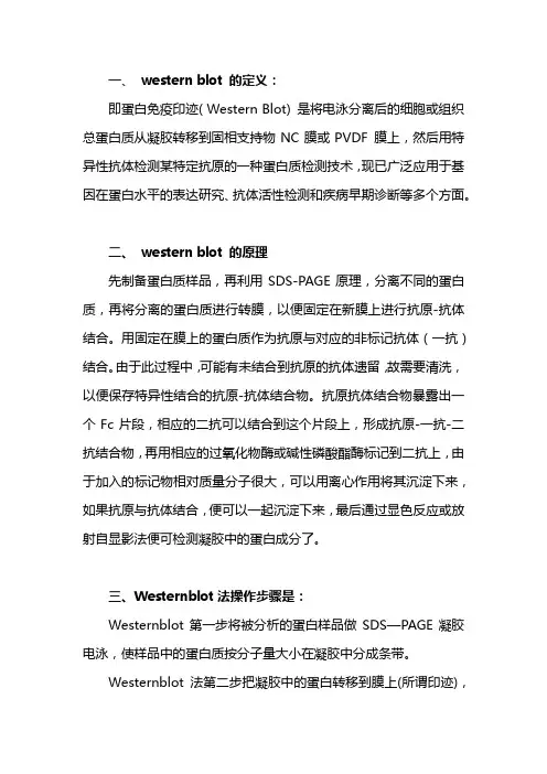 westernblot原理及步骤 2