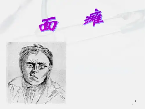 面瘫  ppt课件