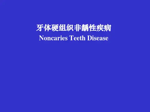 【口腔PPT课件】牙体硬组织非龋性疾病
