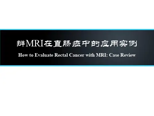 高分辨MRI在直肠癌中应用实例